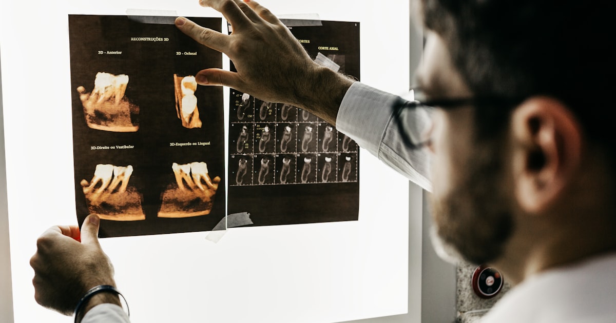 Bruxismo: Causas, Sintomas e Tratamentos para Proteger Seus Dentes