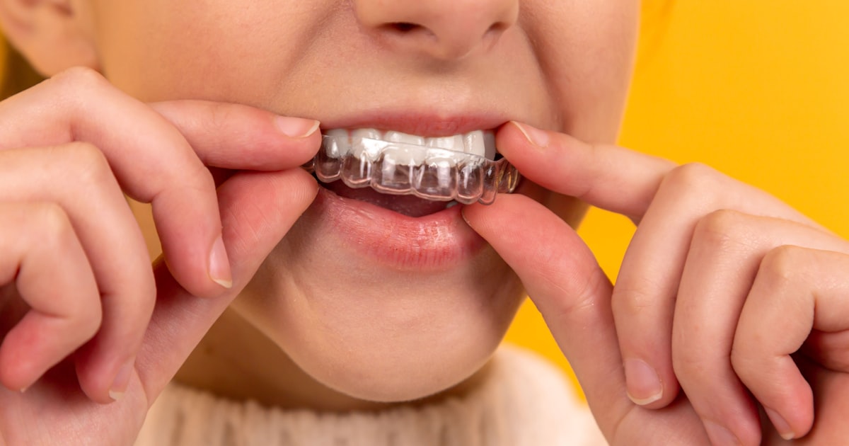 Planos Odontológicos - Como Escolher o Melhor para Você